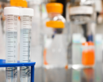 UniPa, in collaborazione con il CNR, avvia studio sperimentale sulla genetica del Coronavirus su pazienti COVID-19 della Sicilia Occidentale