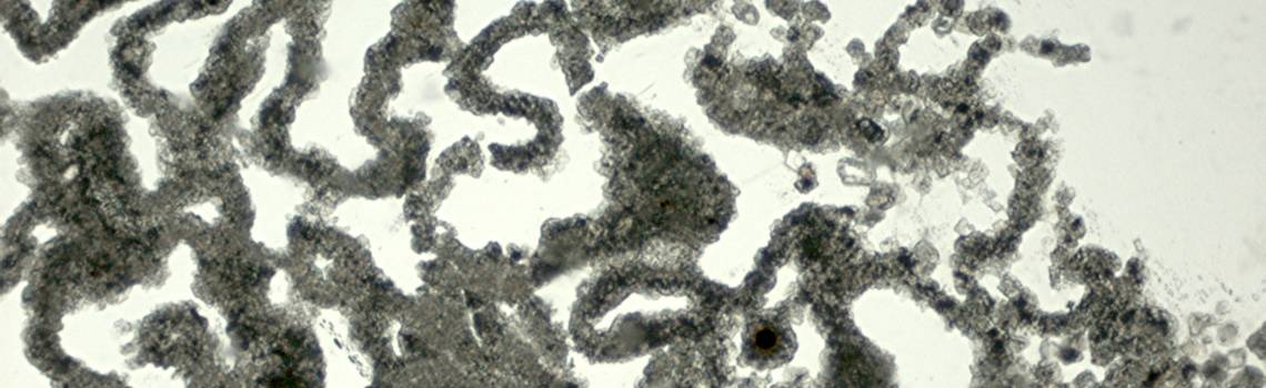 Microfotografie al microscopio ottico polarizzatore di dolomite precipitata per mediazione batterica su gesso (Petralia, Sicilia). A: PPL (Plane Polarized Light).