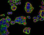 Pubblicato su “Journal of Extracellular Vesicles” uno studio sulle vescicole extracellulari utile alla ricerca contro il cancro col contributo di ricercatori del BiND e dello STeBiCeF di UniPa